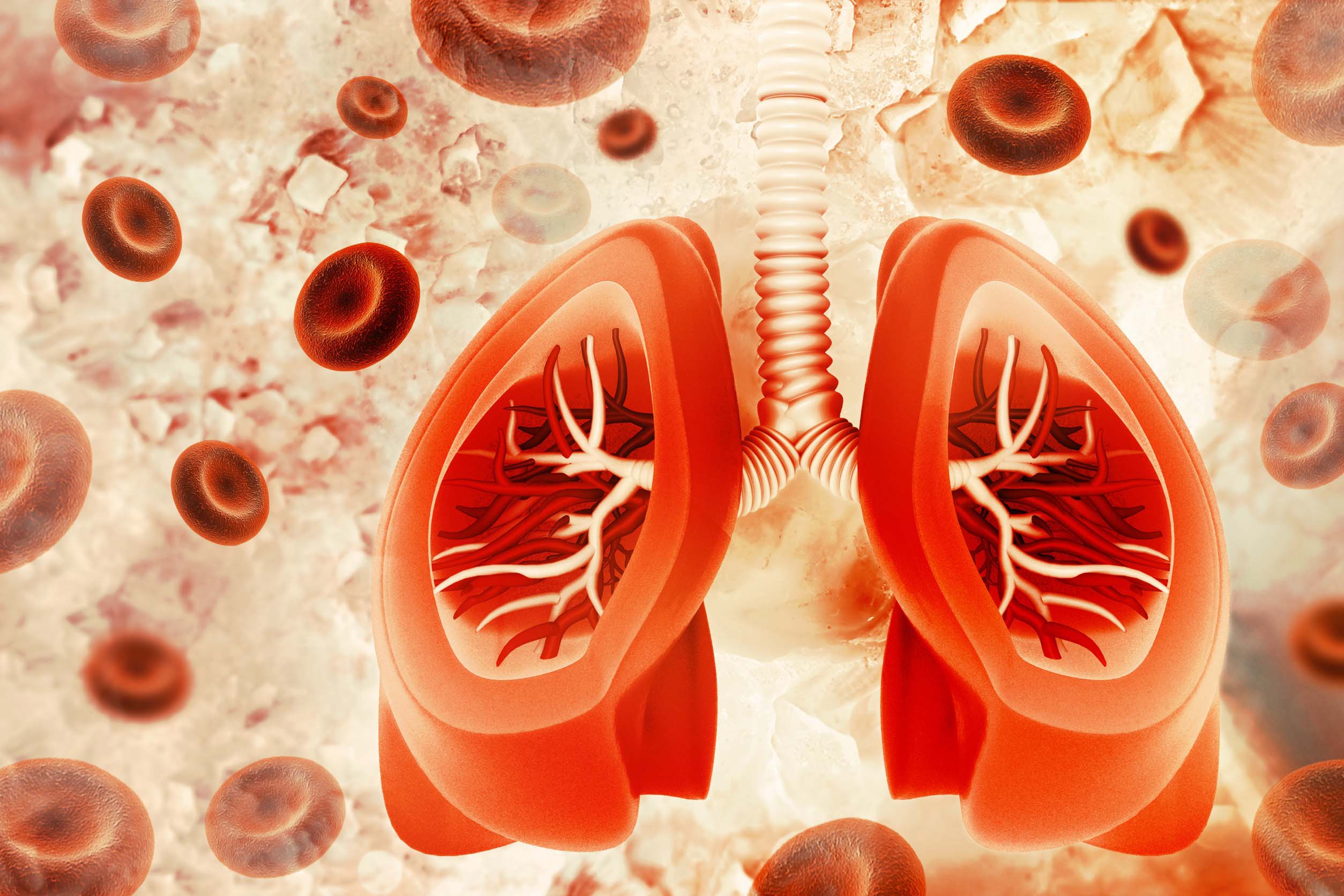 Respiratory Disease