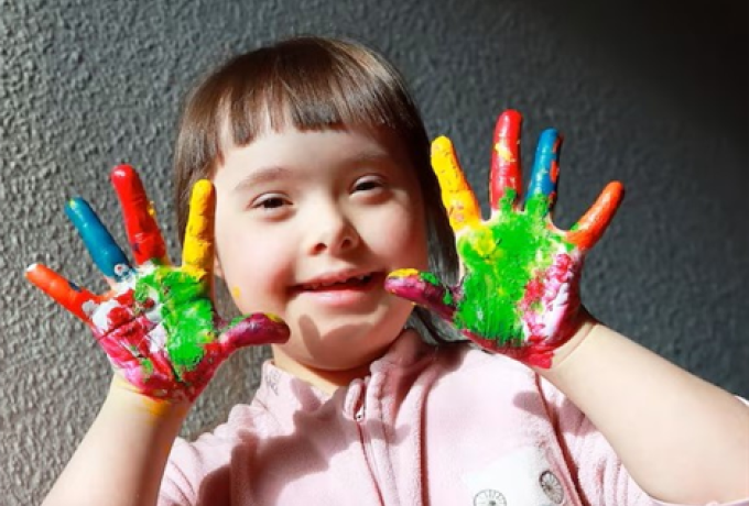 What is Down Syndrome?