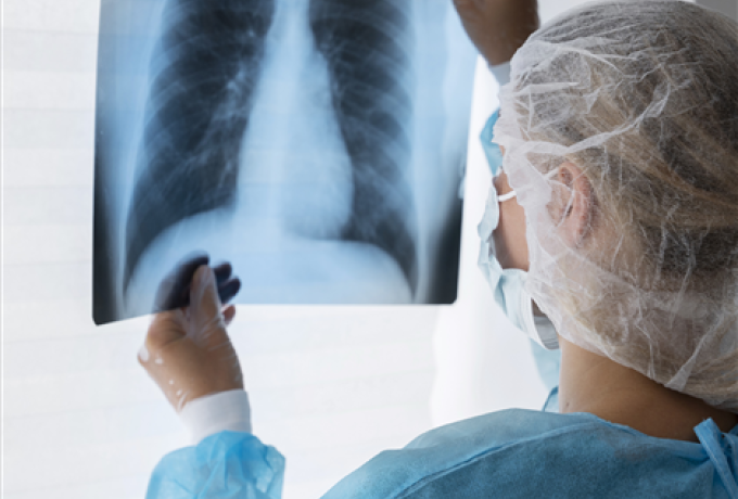 What is Tuberculosis (TB)?